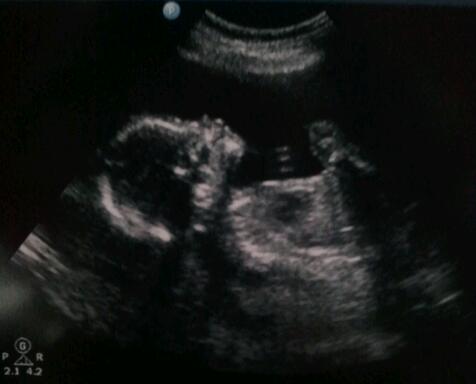 2010-09-09 BjornsProfile.jpg