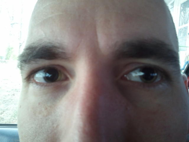 2010-12-06 JessesEyesDilated.jpg