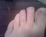 2010_0118BrokeMyToe.jpg